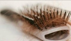 如何預防年輕人脫發(fā)!